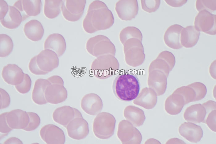 Lymphocyte et hématies x640 - gryphea.org